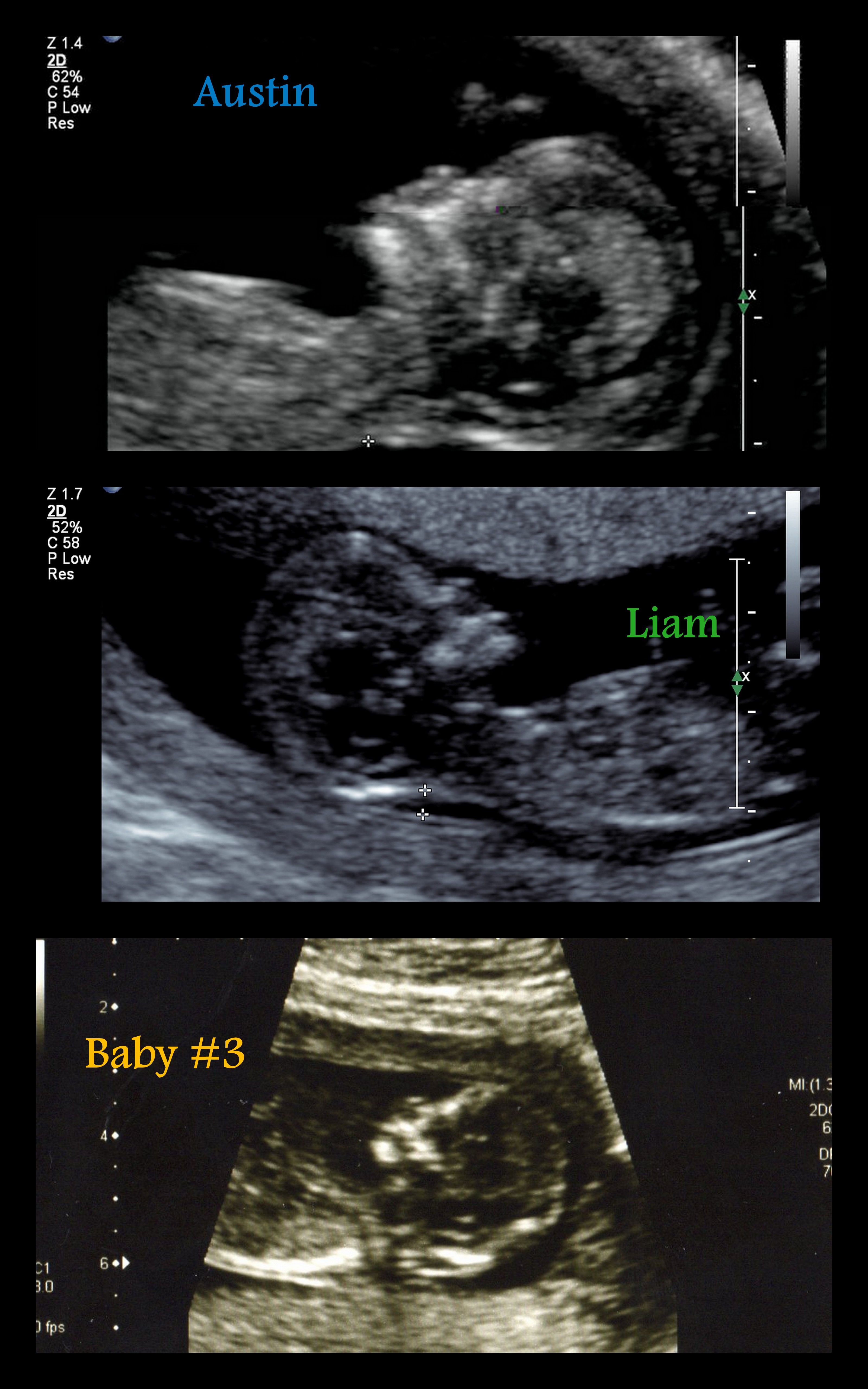 Name:  Pregnant with Austin.jpg
Views: 165
Size:  1.20 MB