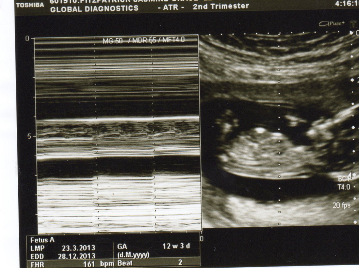 Name:  img043.jpg
Views: 150
Size:  175.0 KB