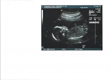 Name:  Baby.jpg
Views: 102
Size:  9.8 KB