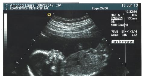 Name:  Baby 3.jpg
Views: 69
Size:  20.2 KB