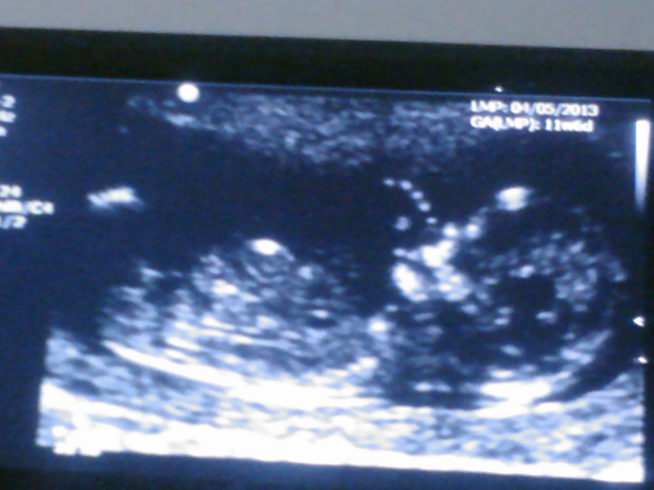 Name:  12 weeks side view.jpg
Views: 906
Size:  686.7 KB