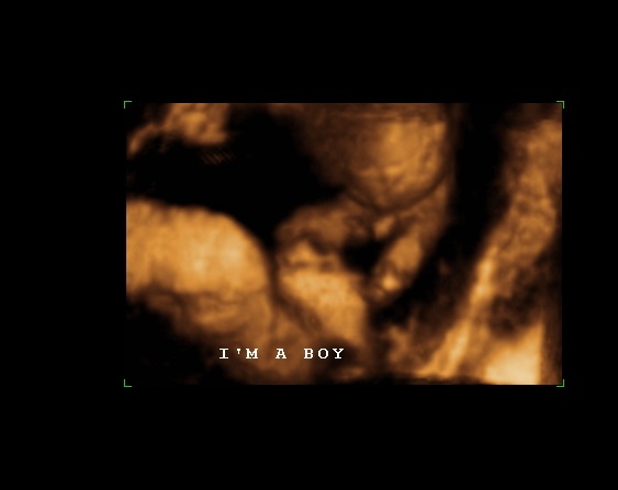 Name:  BOY 4D.jpg
Views: 598
Size:  26.9 KB
