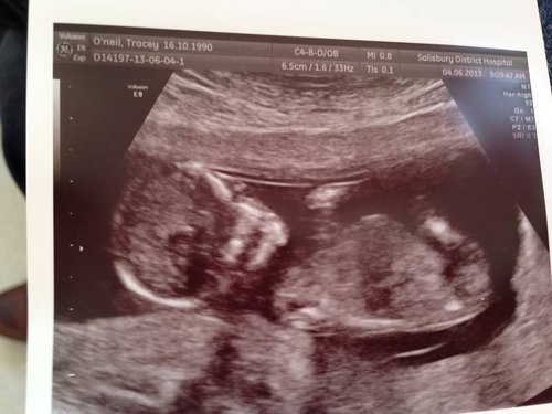 Name:  BABY.jpg
Views: 298
Size:  35.2 KB