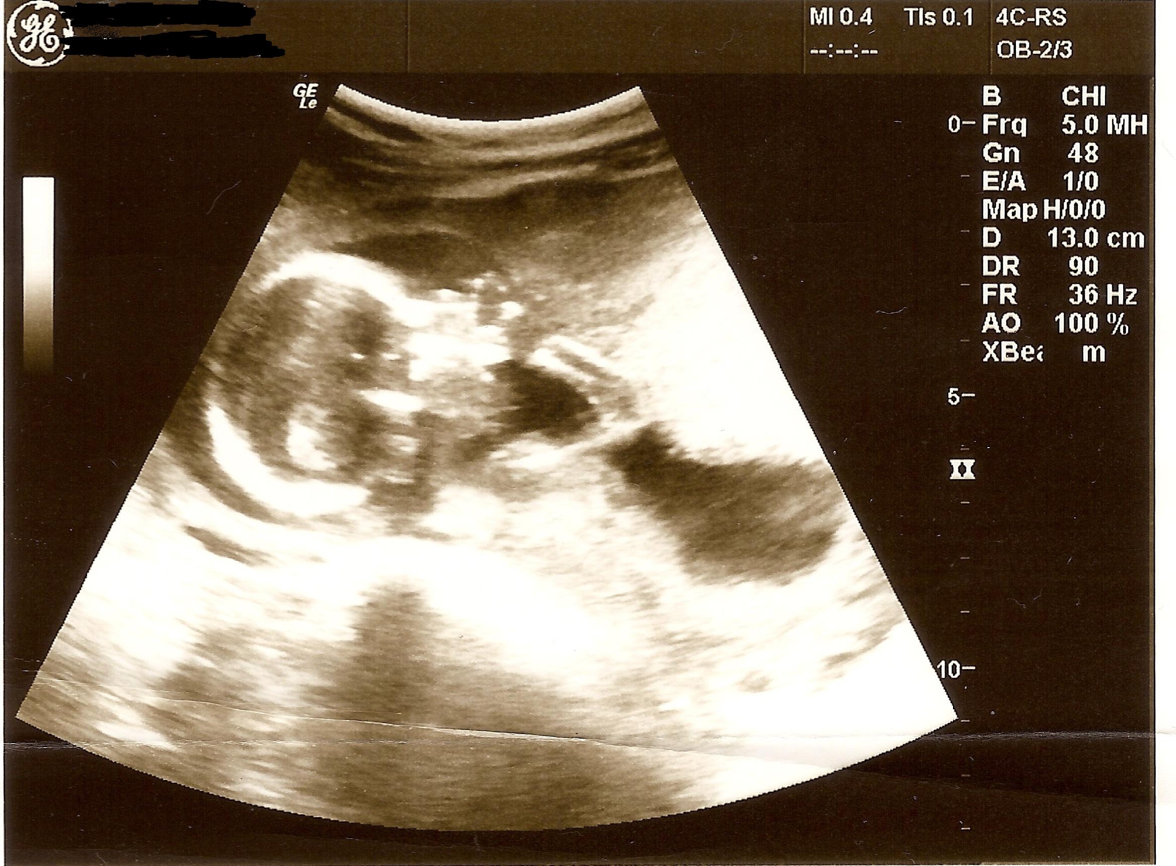 Name:  edited scan0010.JPG
Views: 255
Size:  509.0 KB