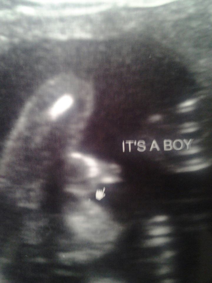 Name:  18w2d anatomy scan.jpg
Views: 93
Size:  61.8 KB