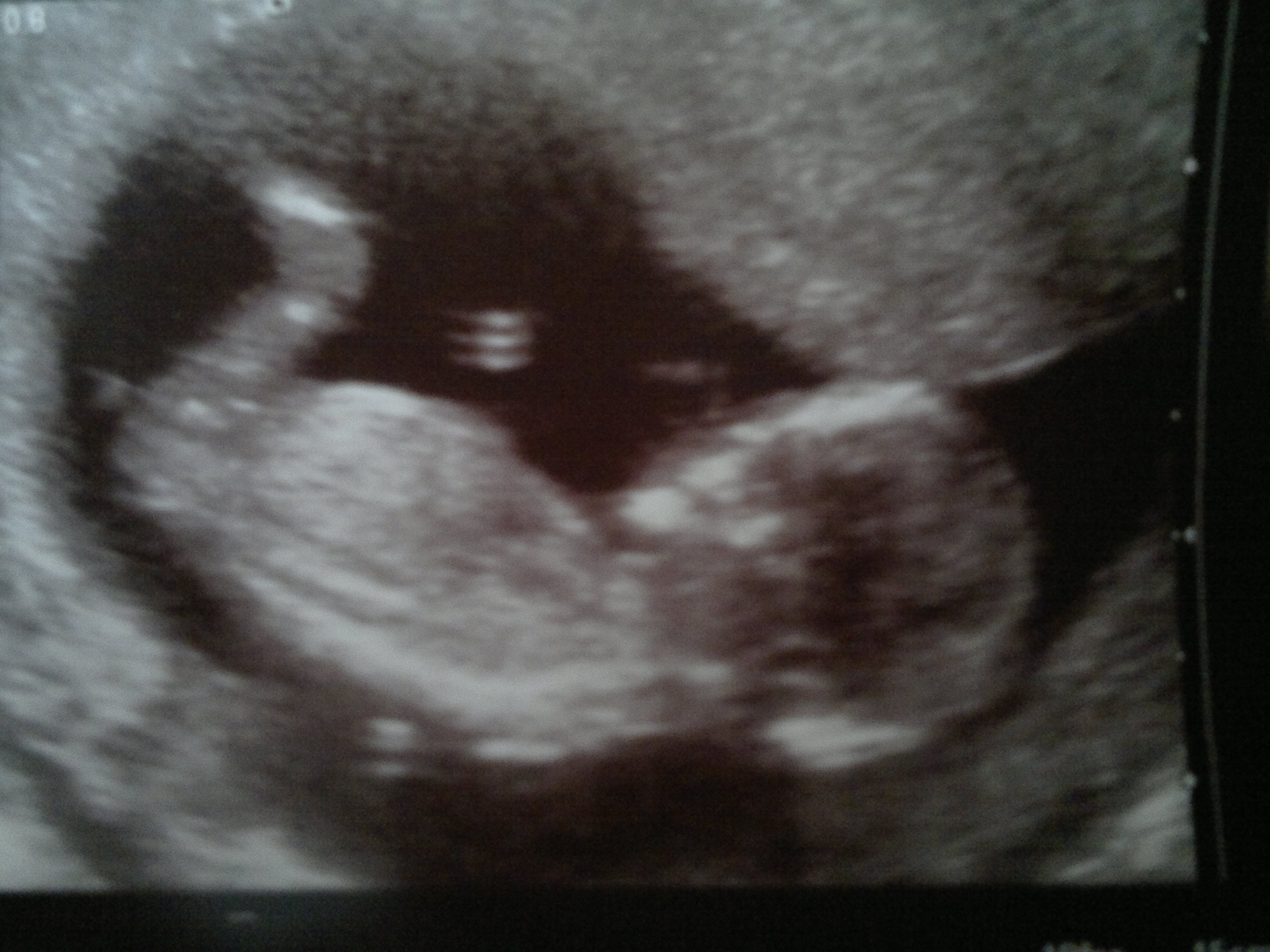 Name:  24012012183.jpg
Views: 226
Size:  1.43 MB