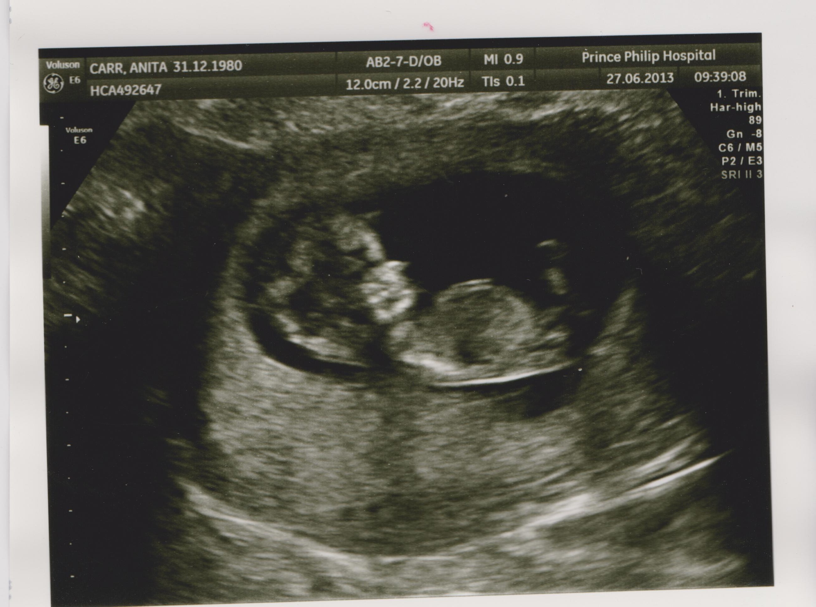 Name:  scan2 001.jpg
Views: 414
Size:  499.8 KB