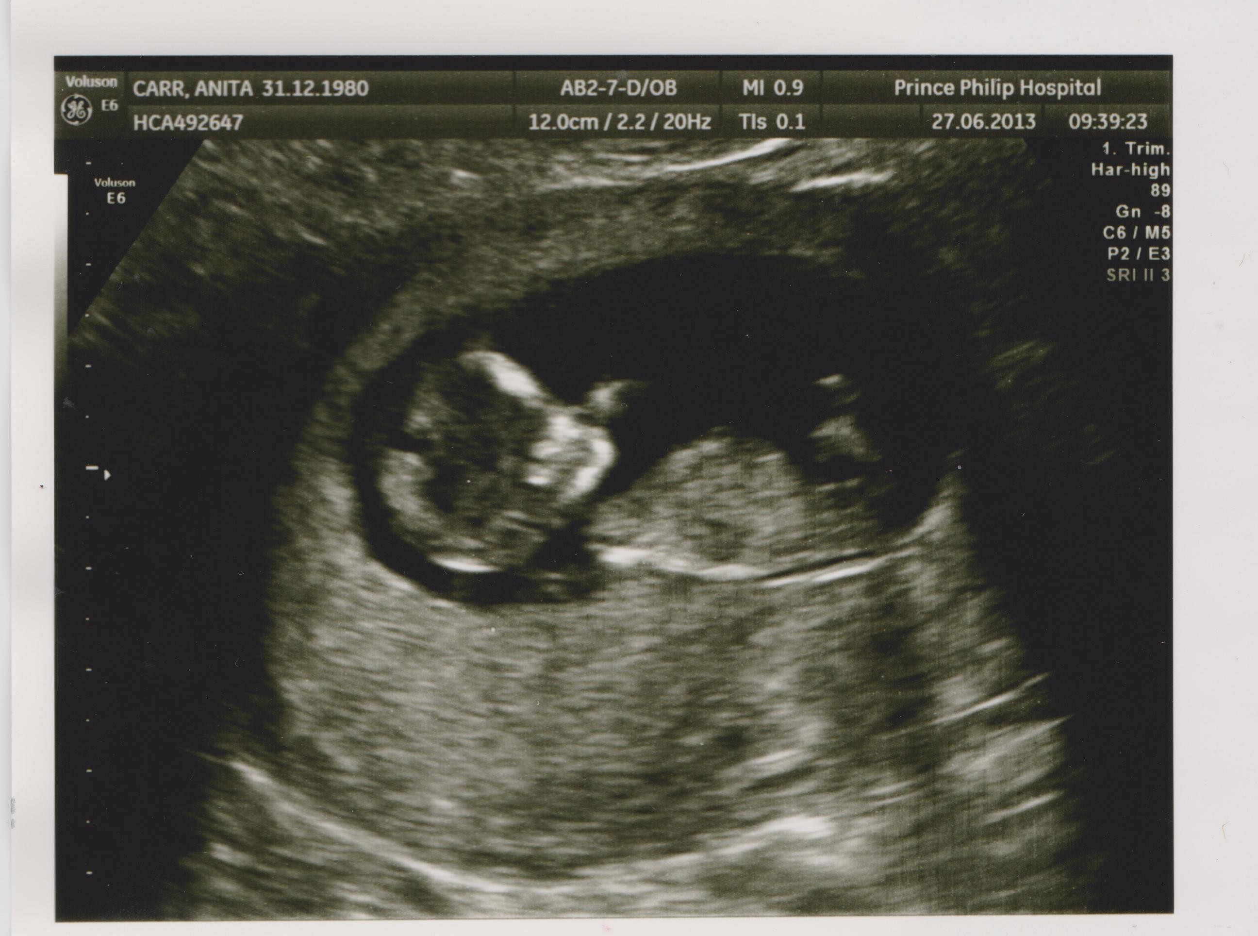 Name:  scan2 002.jpg
Views: 134
Size:  504.5 KB