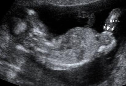 Name:  babygirl.jpg
Views: 207
Size:  18.2 KB