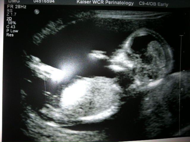 Name:  ntscan3.JPG
Views: 79
Size:  105.3 KB