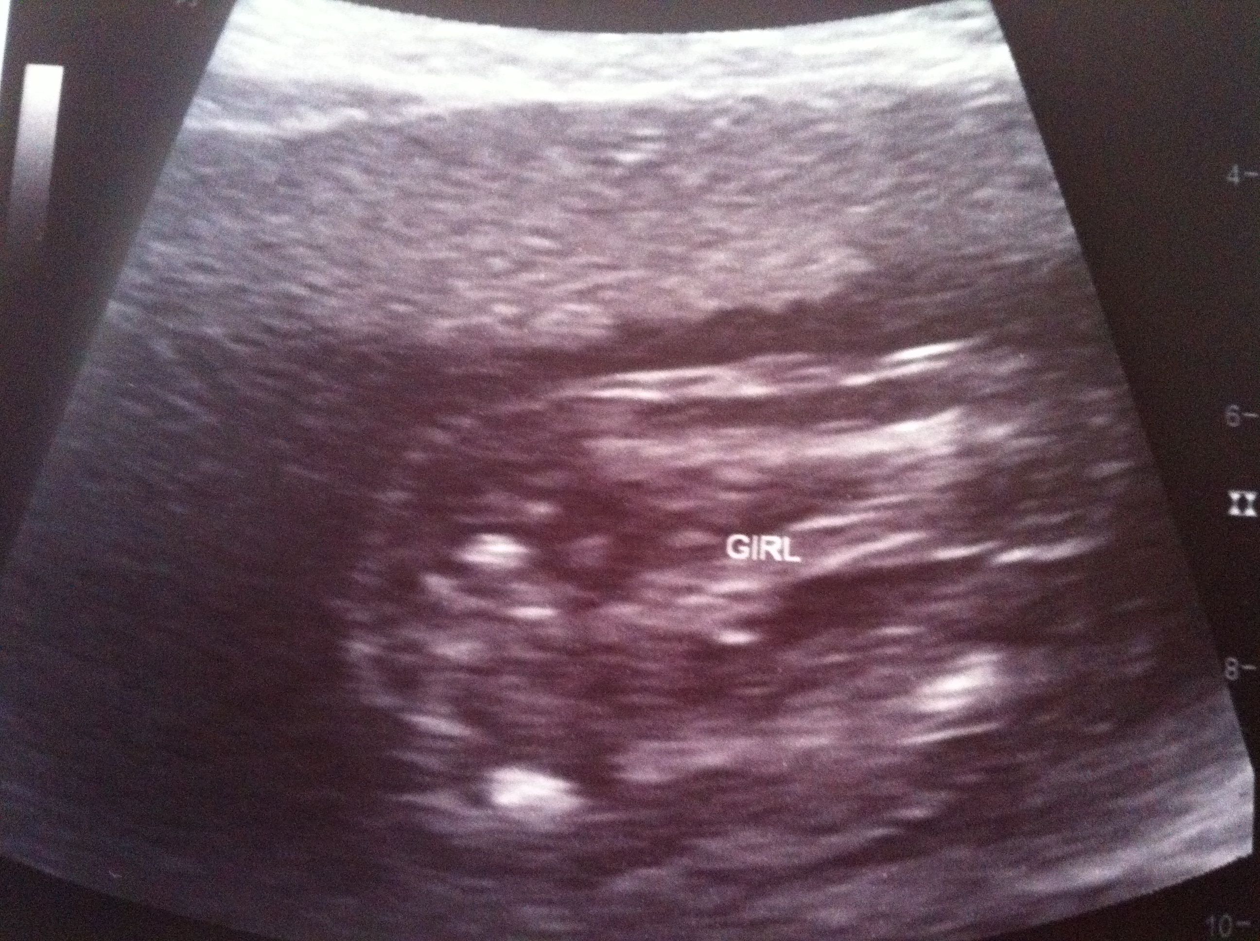 Name:  20 Week U:S.jpg
Views: 12538
Size:  879.8 KB