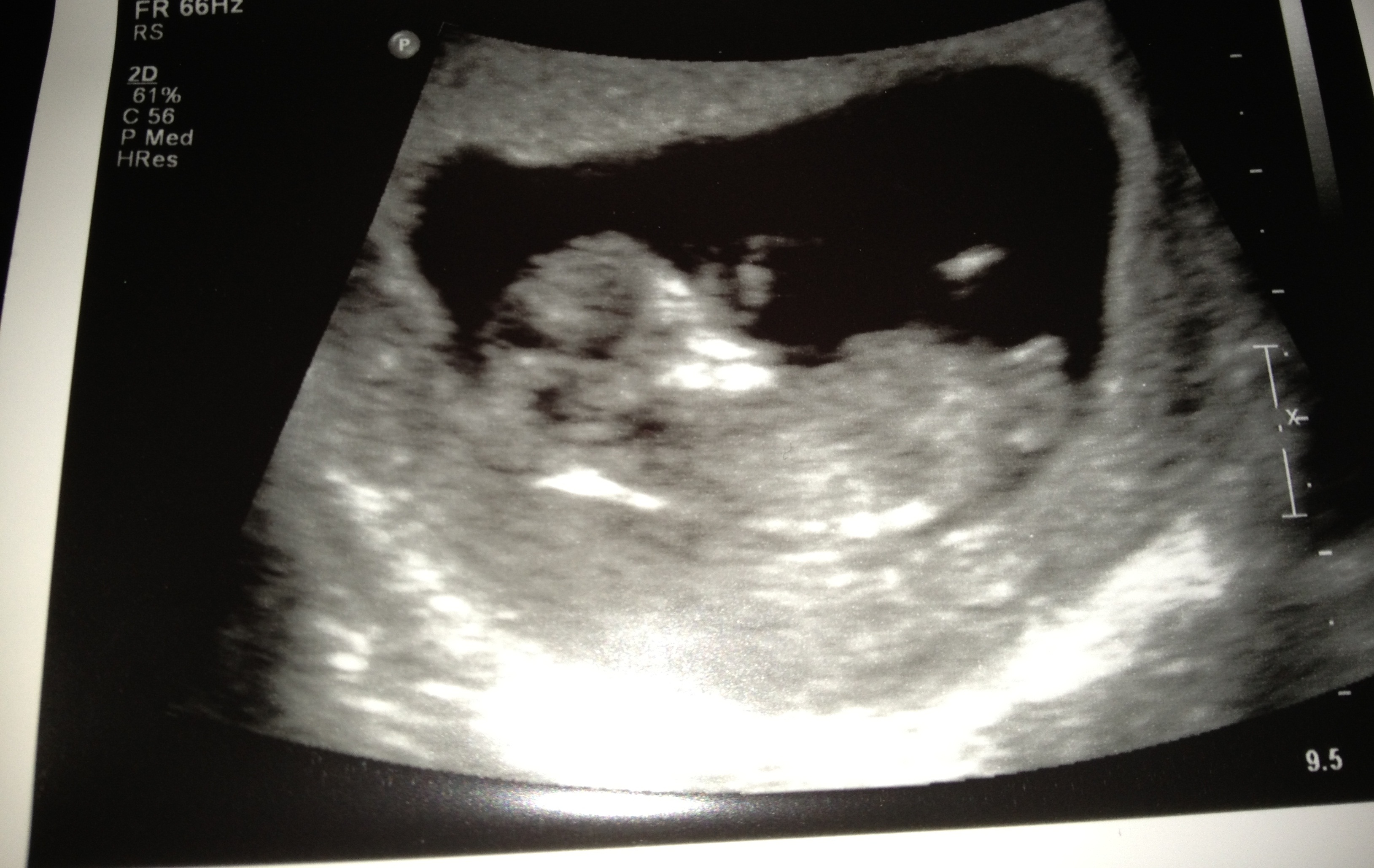 Name:  11weeks1.jpg
Views: 93
Size:  1.14 MB