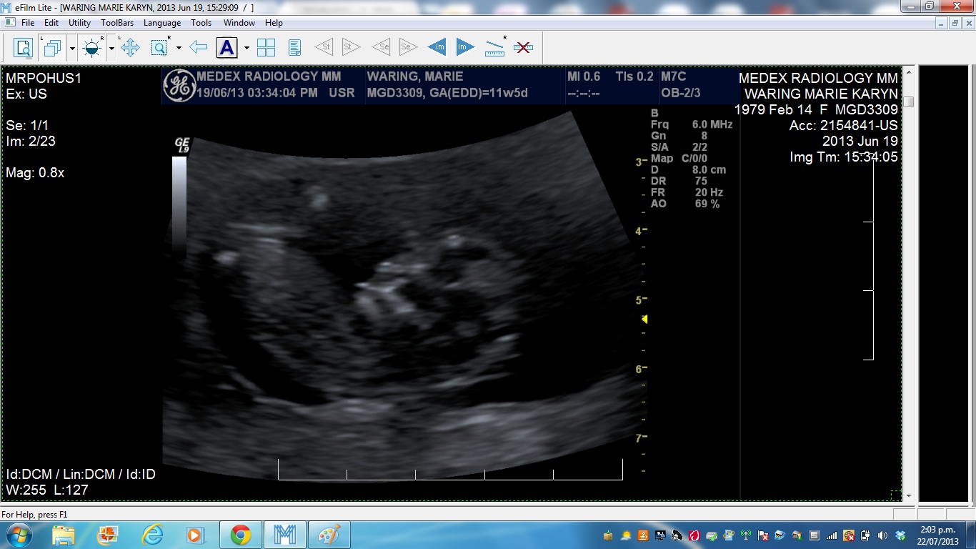 Name:  photo2.jpg
Views: 173
Size:  231.0 KB