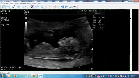 Name:  Photo5.jpg
Views: 148
Size:  19.5 KB
