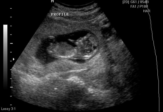 Name:  BABY PICS_1.jpg
Views: 303
Size:  31.1 KB