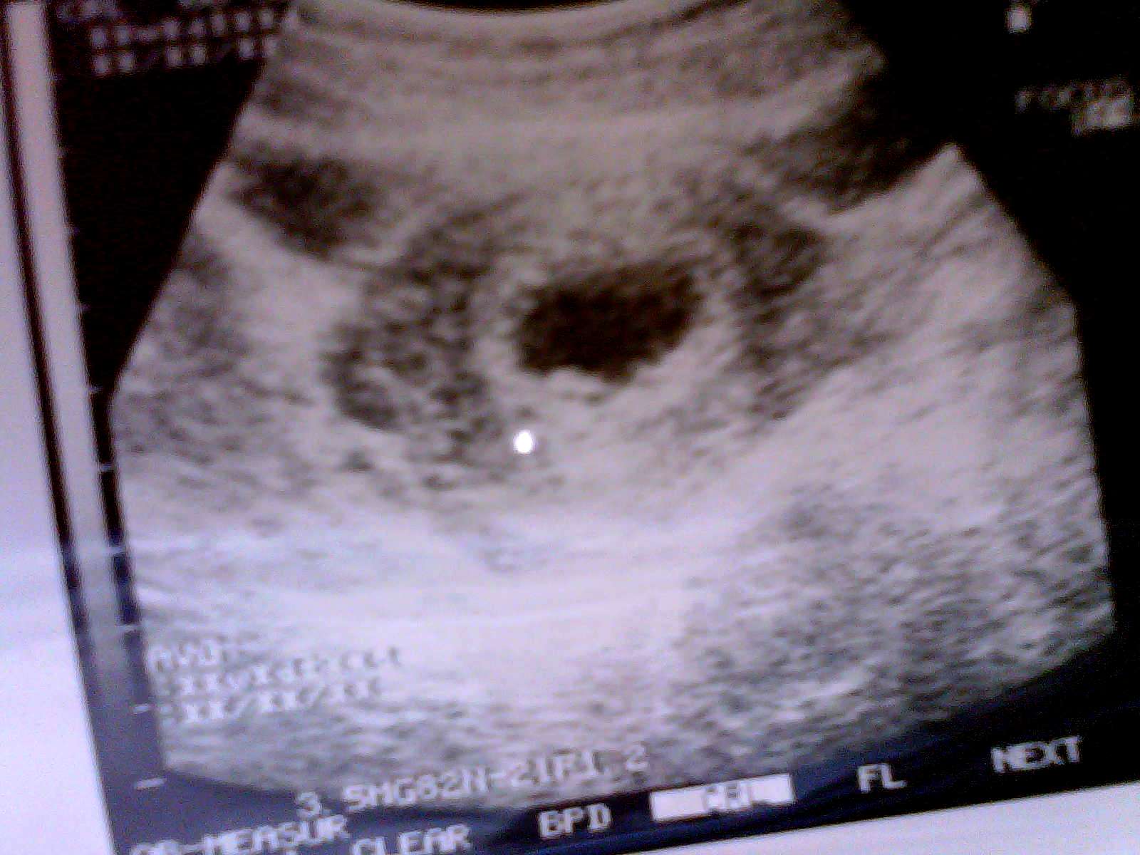 Name:  baby.jpg
Views: 294
Size:  146.1 KB