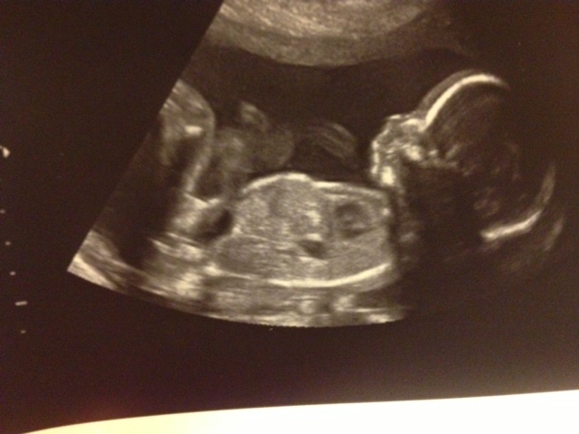Name:  20 wk.jpg
Views: 126
Size:  93.9 KB