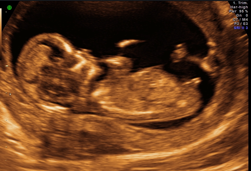 Name:  baby_2.jpg
Views: 142
Size:  297.4 KB