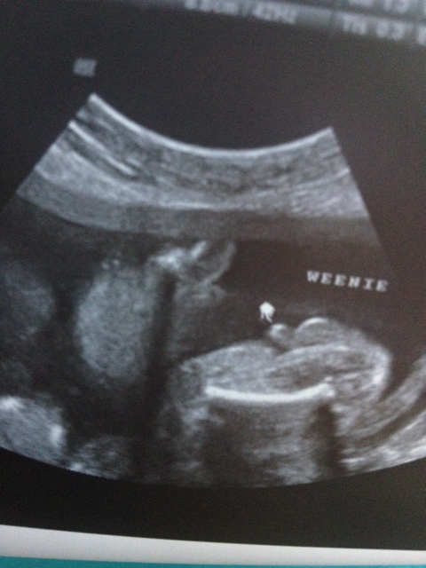 Name:  ultrasound 2.jpg
Views: 97
Size:  120.0 KB