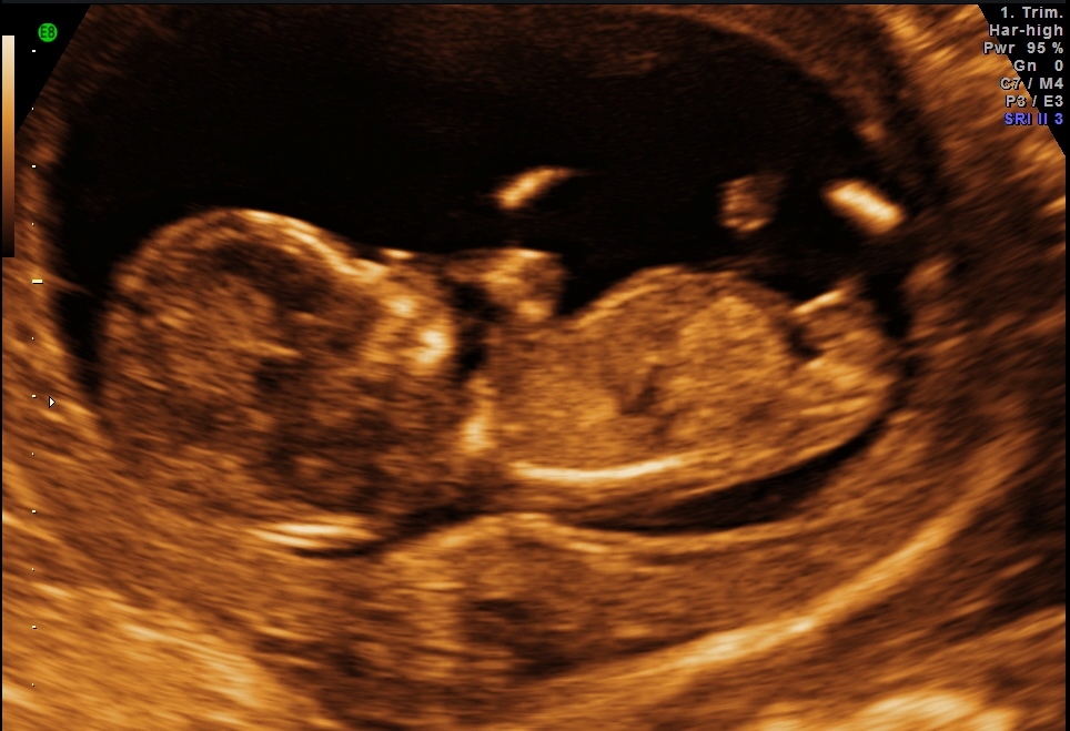 Name:  baby_3.jpg
Views: 262
Size:  283.4 KB
