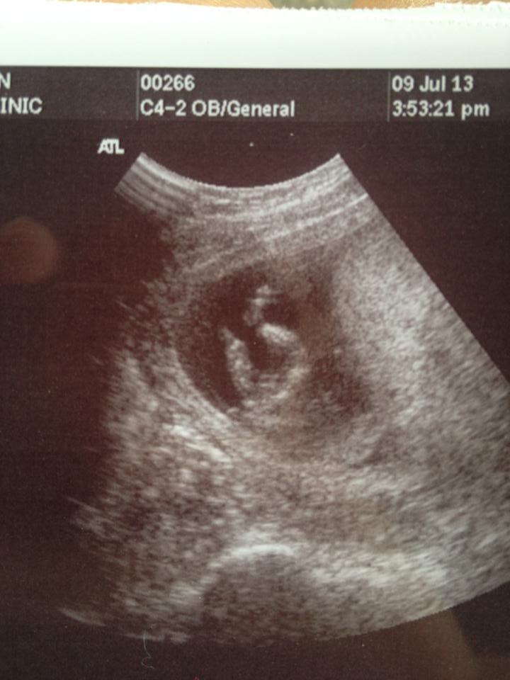 Name:  baby girl.jpg
Views: 67
Size:  62.4 KB