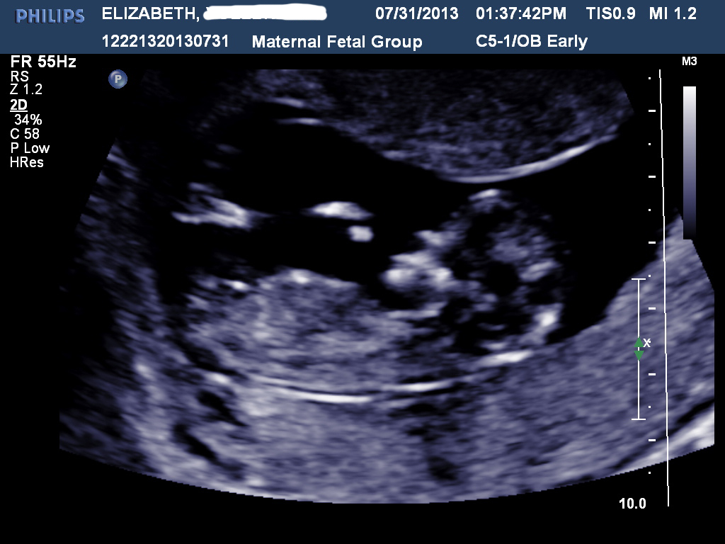 Name:  baby2.jpg
Views: 254
Size:  256.3 KB