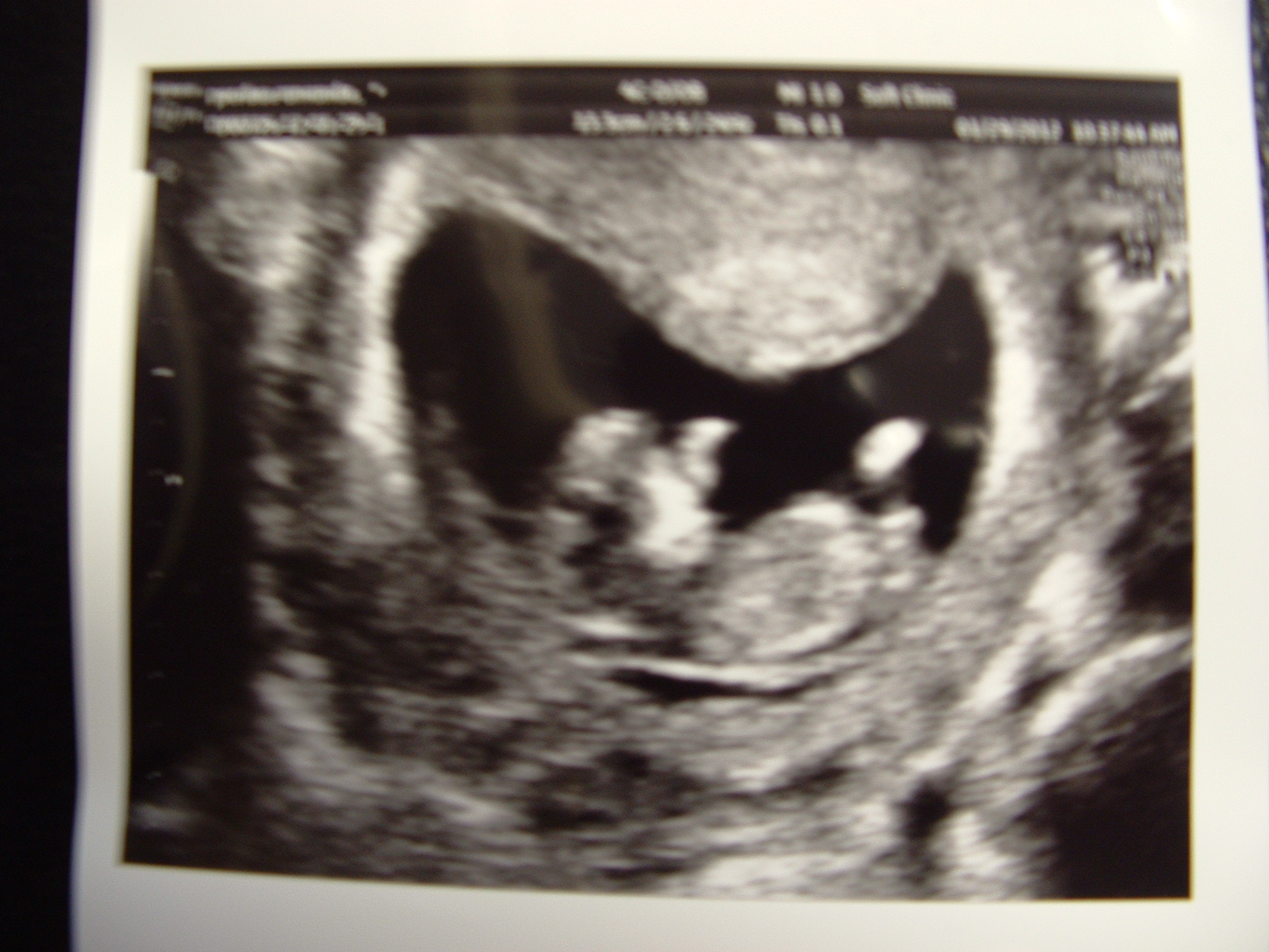 Name:  Jan29th~11W.JPG
Views: 114
Size:  860.5 KB