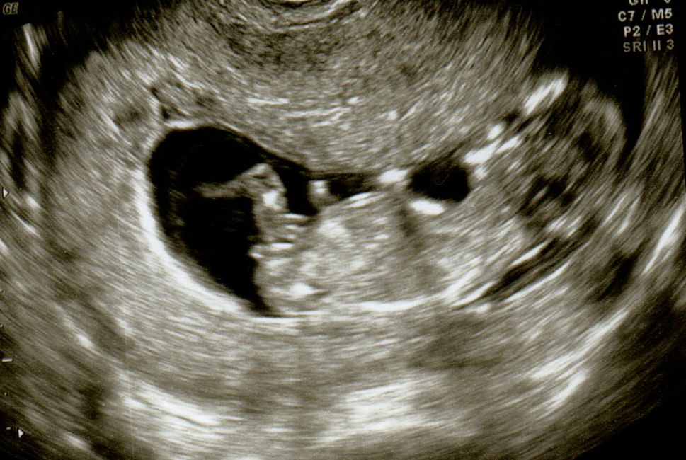 Name:  Baby pics1005.jpg
Views: 123
Size:  276.4 KB