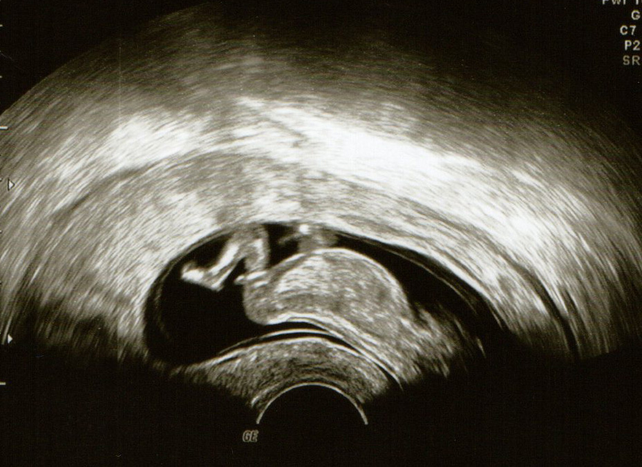 Name:  Baby pics003.jpg
Views: 122
Size:  231.8 KB