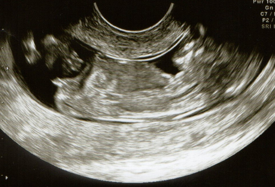 Name:  Baby pics002.jpg
Views: 91
Size:  245.7 KB