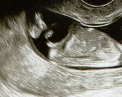 Name:  Baby pics001.jpg
Views: 119
Size:  74.5 KB
