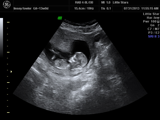 Name:  13 WEEKS_2.JPG
Views: 132
Size:  91.6 KB