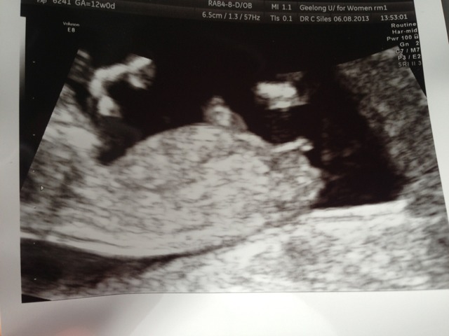 Name:  ImageUploadedByTapatalk1375761992.955300.jpg
Views: 1552
Size:  55.6 KB