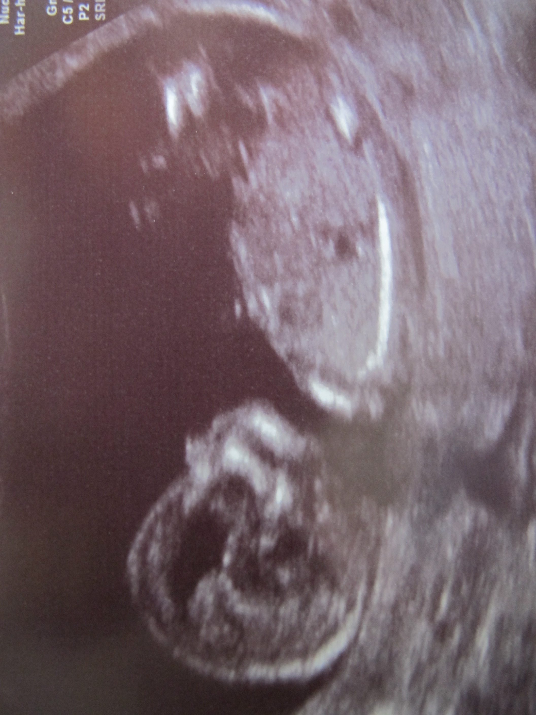 Name:  12 week scan Jan 2012 002.JPG
Views: 470
Size:  1.08 MB