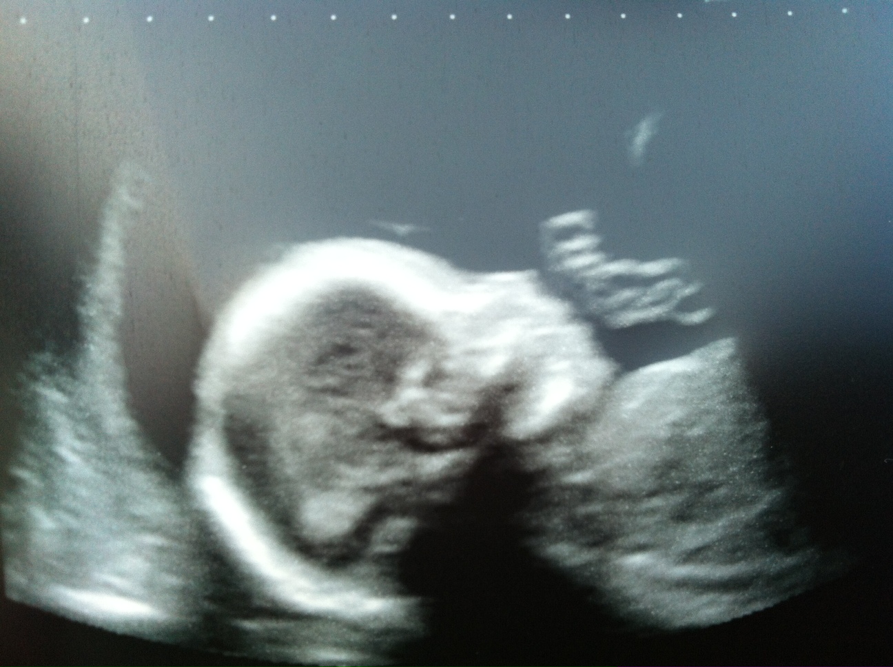 Name:  baby20week.JPG
Views: 513
Size:  419.2 KB