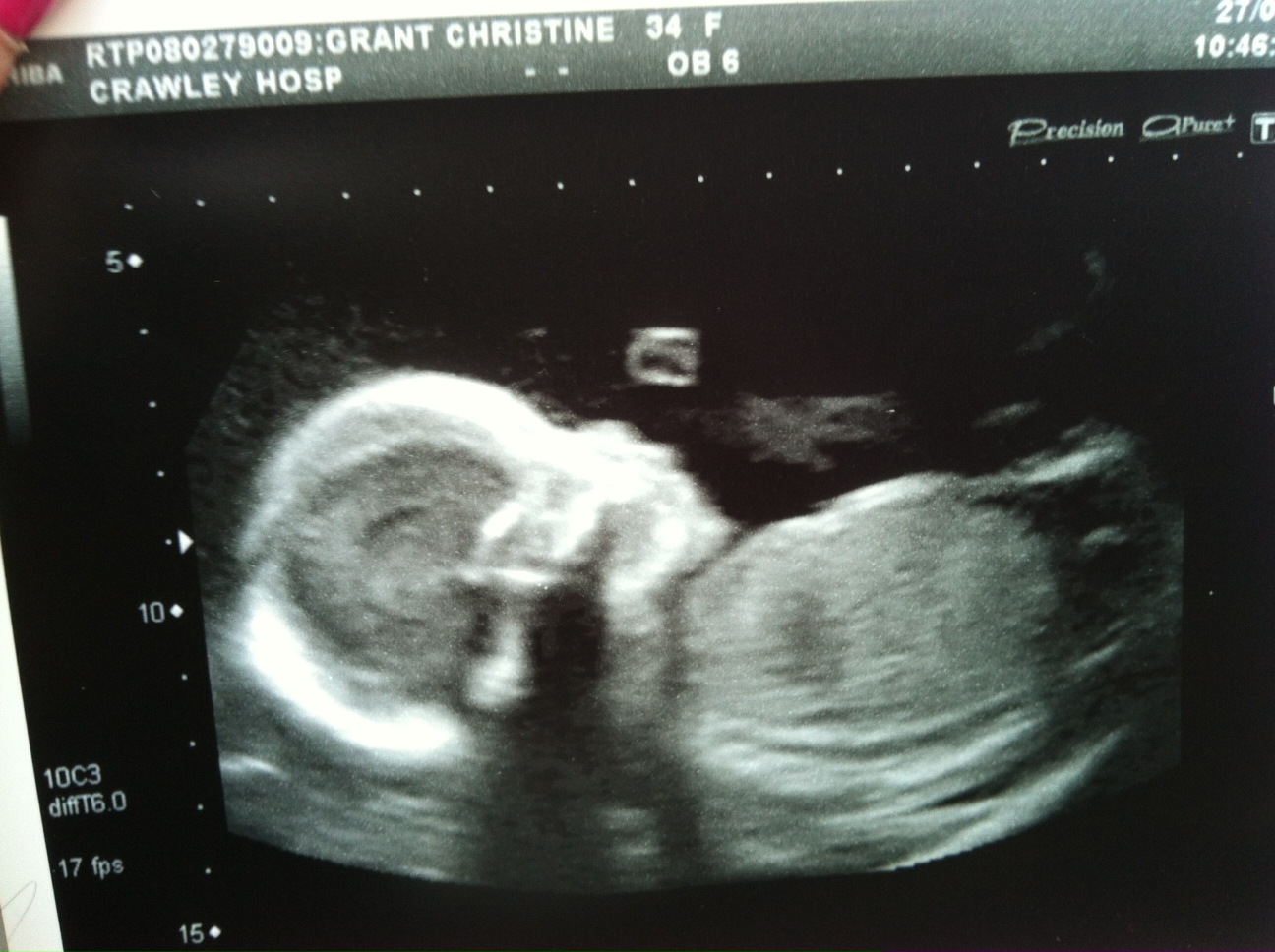 Name:  baby420week.JPG
Views: 570
Size:  377.2 KB