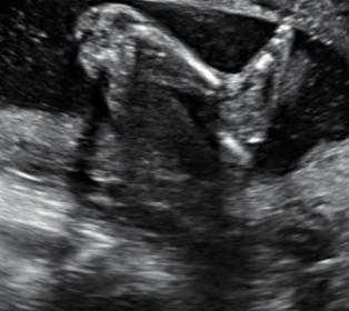 Name:  bebe 19 weeks3.jpg
Views: 212
Size:  14.8 KB