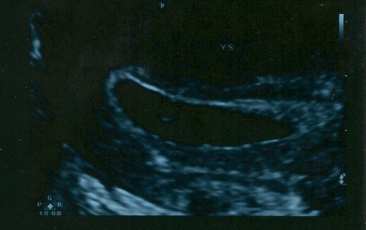 Name:  scan10002_e.jpg
Views: 1552
Size:  83.7 KB