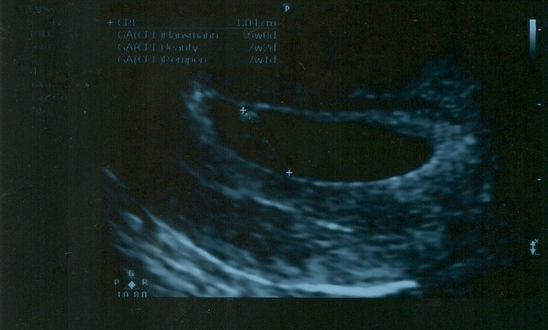 Name:  scan10003_e.jpg
Views: 1244
Size:  87.8 KB