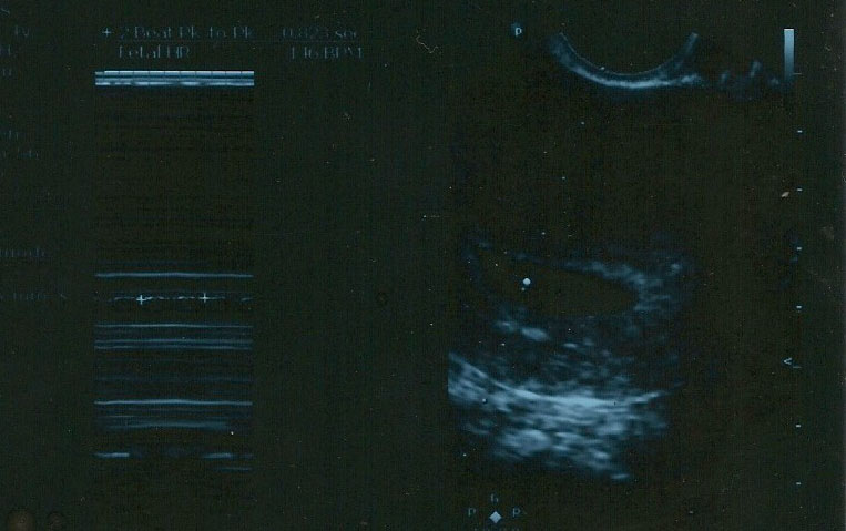 Name:  scan10004_e.jpg
Views: 1313
Size:  79.2 KB