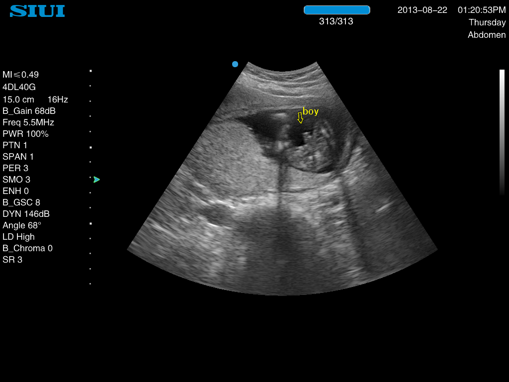 Name:  130822-132113.bmp
Views: 1124
Size:  3.01 MB