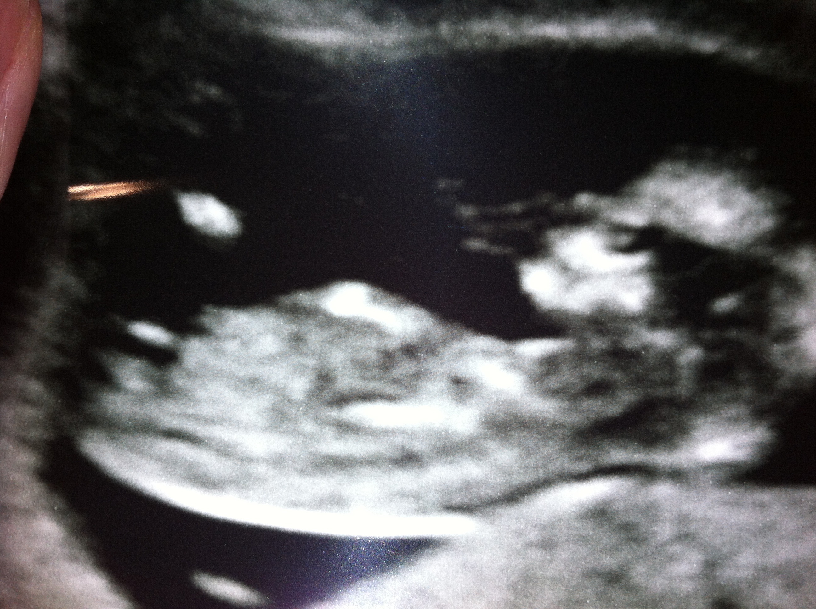 Name:  image.jpg
Views: 250
Size:  1.50 MB