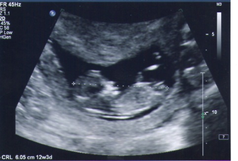 Name:  img005.jpg
Views: 186
Size:  50.9 KB