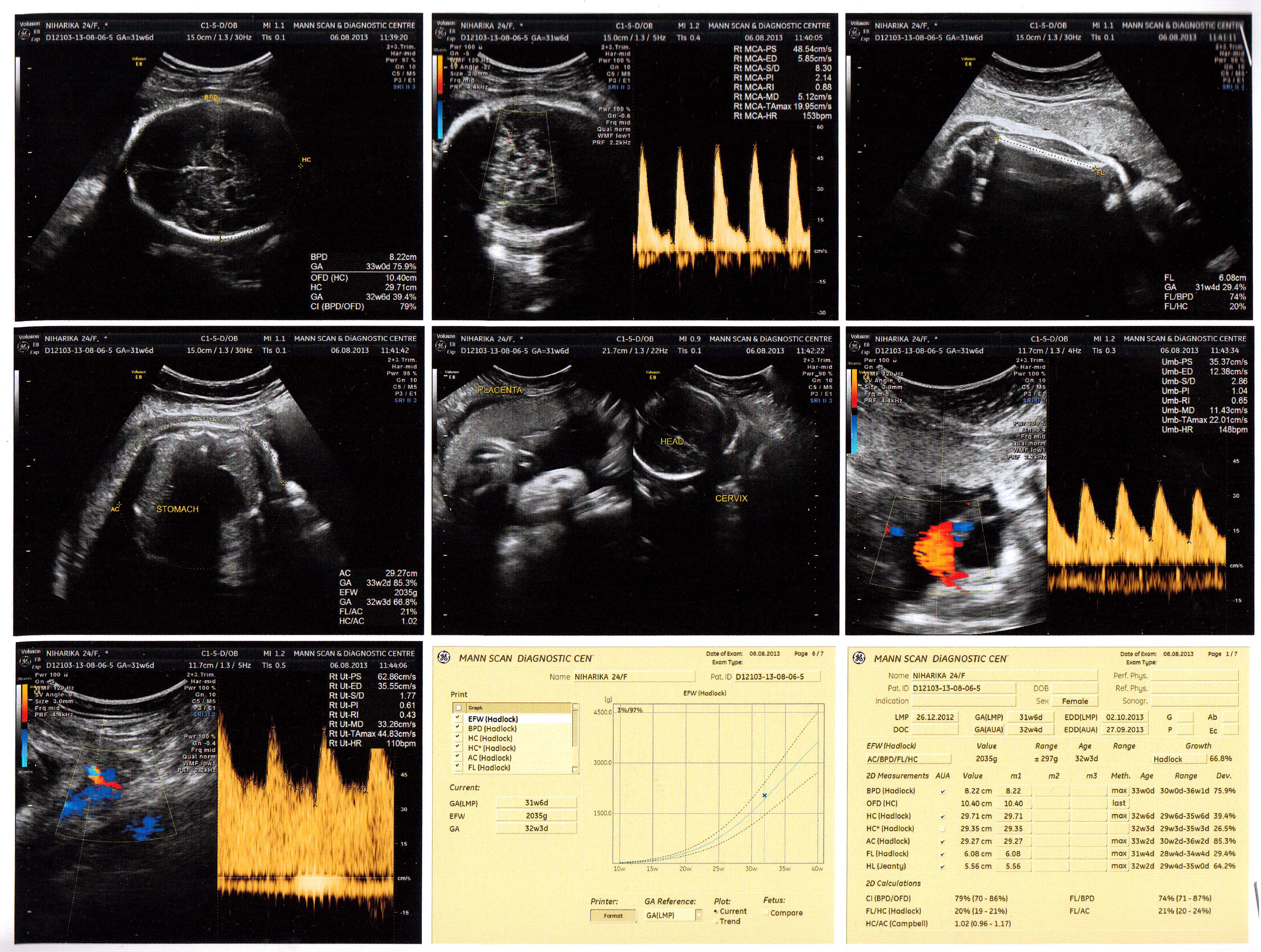 Name:  Ultrasound - 2cvcvc.jpg
Views: 380
Size:  1.01 MB