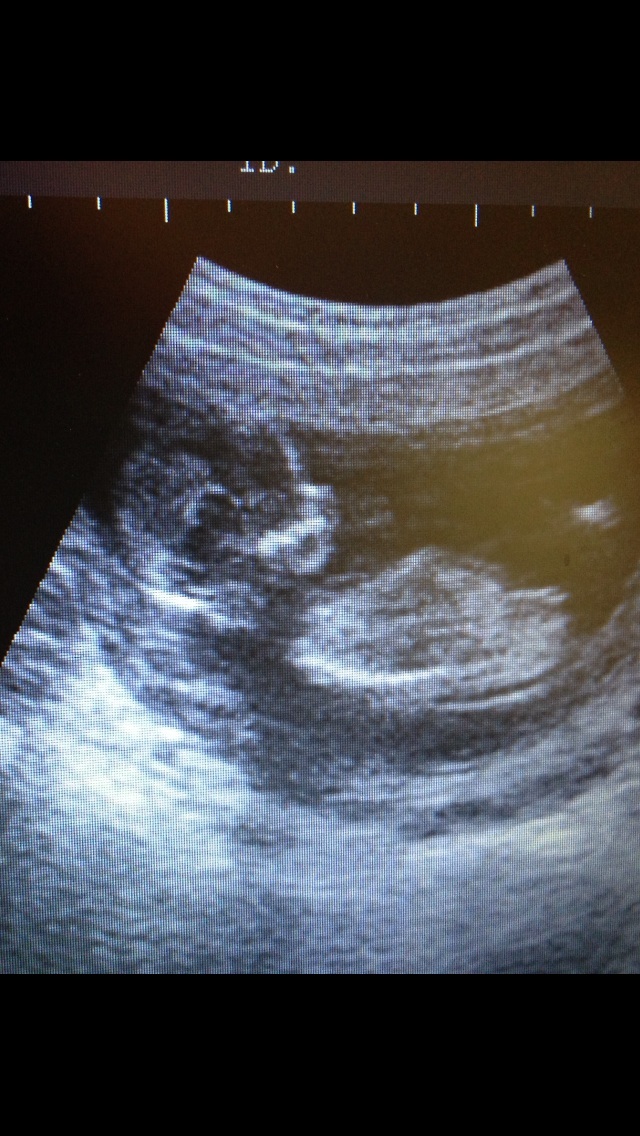 Name:  image.jpg
Views: 193
Size:  232.8 KB