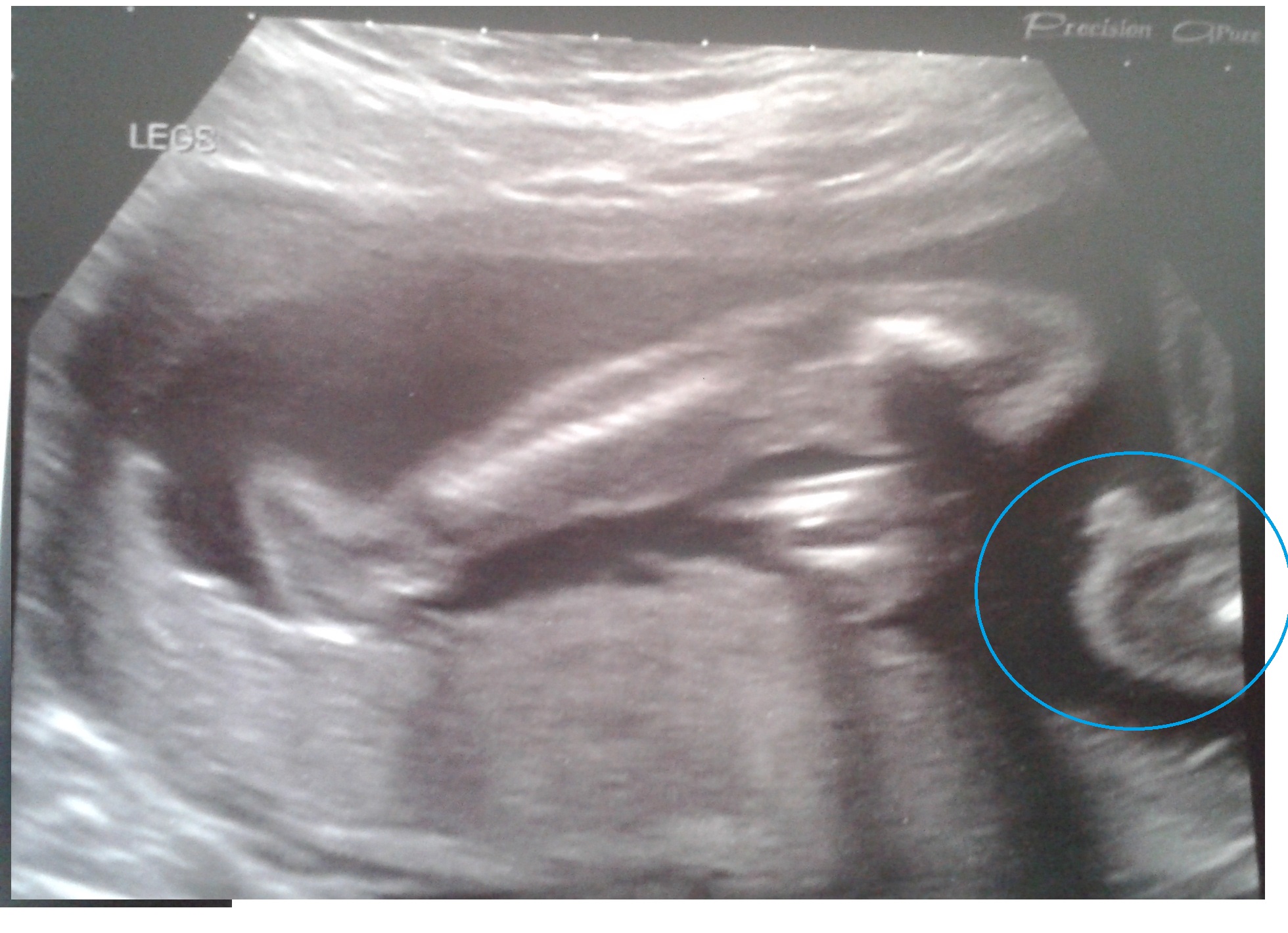 Name:  ItsaBoy.jpg
Views: 172
Size:  516.1 KB