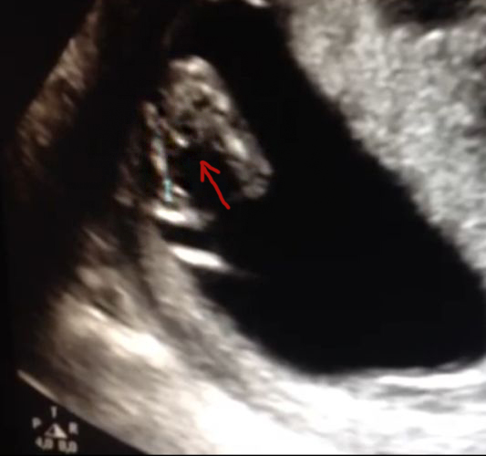 Name:  baby lotte.jpg
Views: 148
Size:  101.2 KB