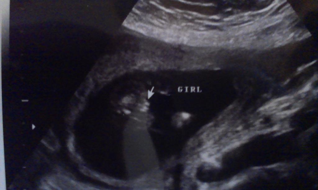 Name:  baby girl2.jpg
Views: 215
Size:  48.2 KB