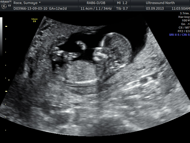 Name:  Race Baby #3.jpg
Views: 4253
Size:  120.0 KB