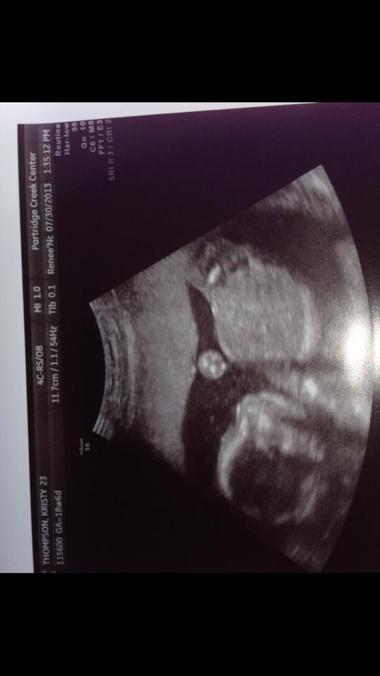 Name:  baby.jpg
Views: 164
Size:  32.5 KB